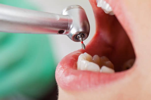 Best Walk-In Emergency Dental Services in Carey, ID